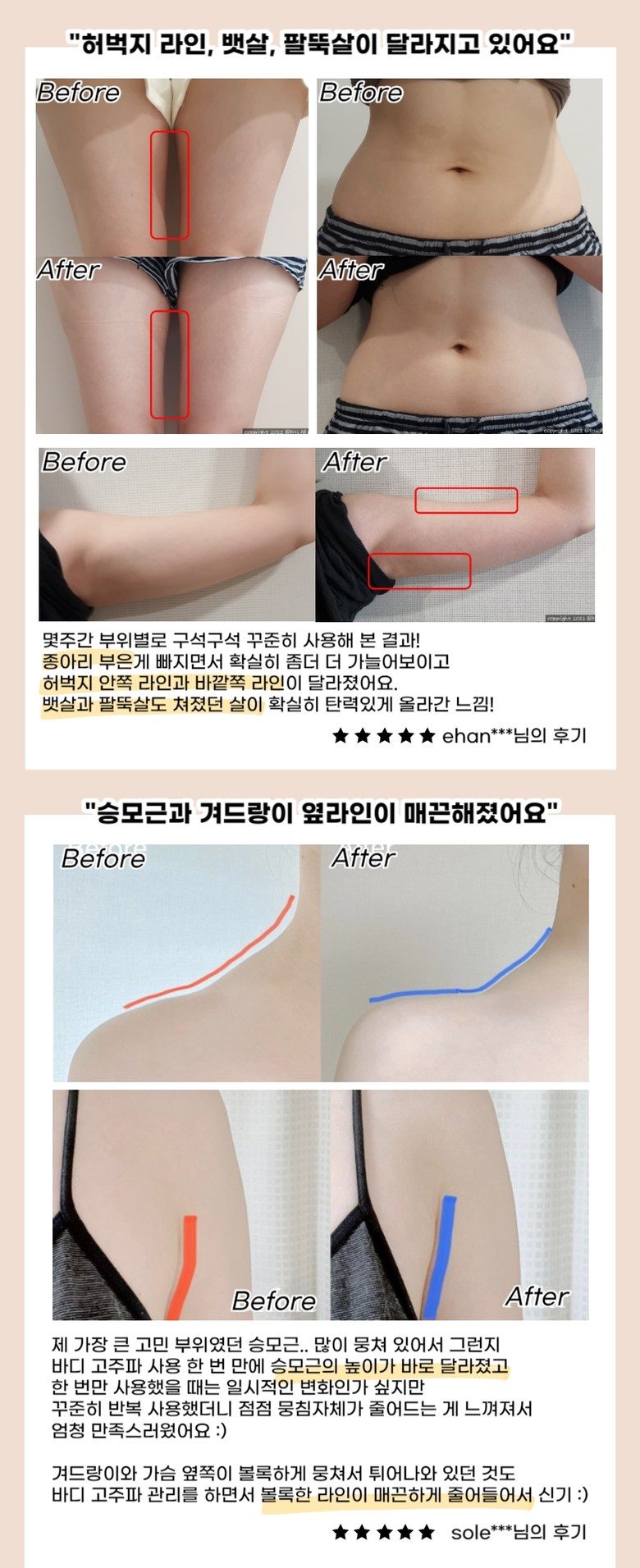 이로위로 바디 고주파 마사지기 온열 갈바닉 초음파 바본관리 가정용고주파기 홈케어 뷰티디바이스