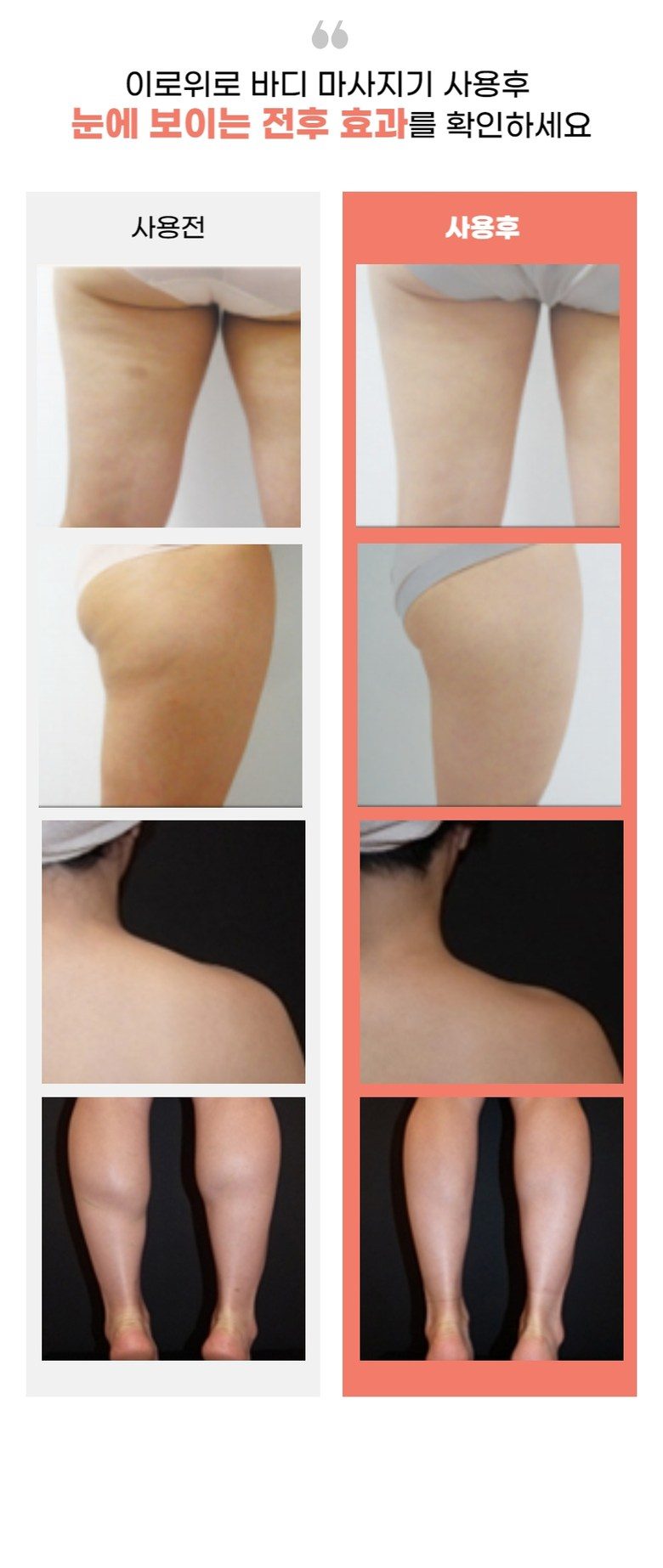 이로위로 바디 고주파 마사지기 온열 갈바닉 초음파 바본관리 가정용고주파기 홈케어 뷰티디바이스