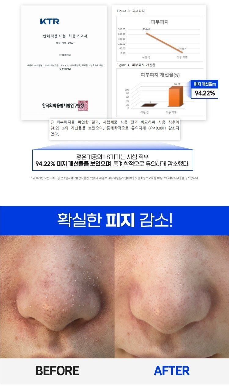 국산 아쿠아필링기 얼굴 코 피지 제거 워터필링 초음파 각질제거기 라벨르L8