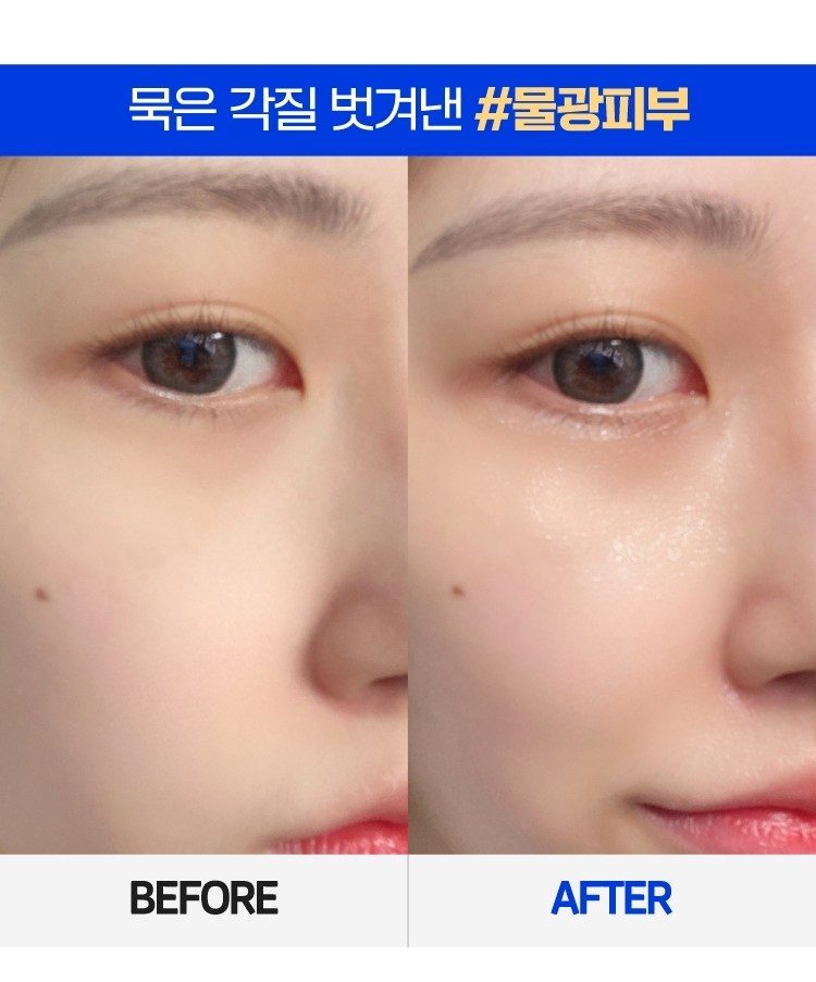 국산 아쿠아필링기 얼굴 코 피지 제거 워터필링 초음파 각질제거기 라벨르L8