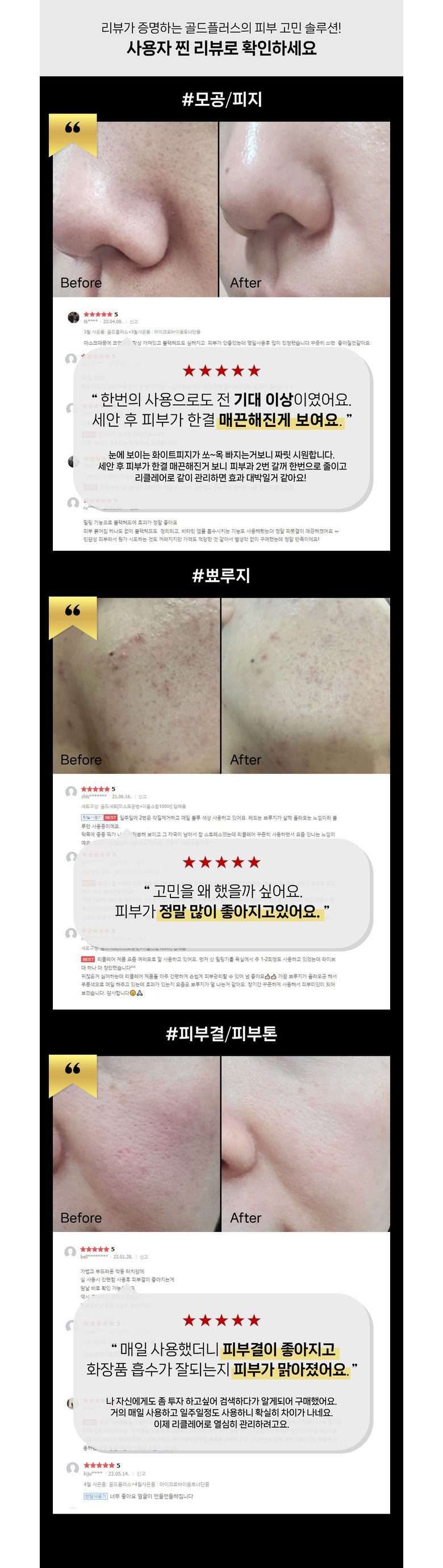 NEW 2023 리클레어 갈바닉 워터필링기 골드 플러스 5 IN 1